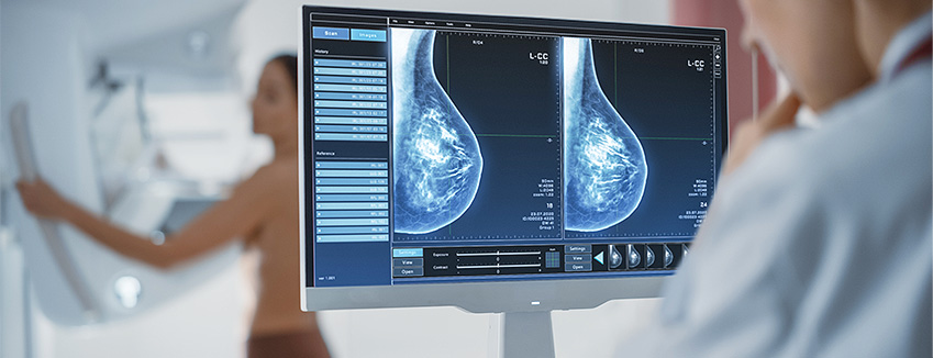 Spezielle Brustdiagnostik / Mammographie